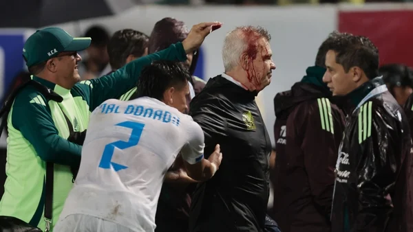 Hold your beer - Honduras punished by CONCACAF